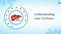 LiverCirrhosis